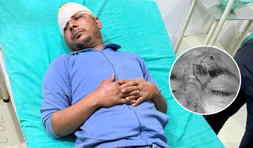  बैतडीमा रास्वपा-एमाले कार्यकर्ताबीच झडप, एमालेका दुई कार्यकर्ता घाइते